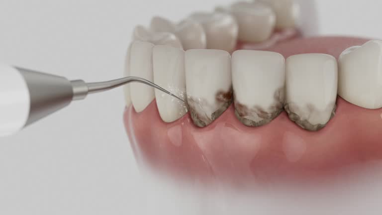 Reliable Dental contractor in Duquesne, MO by Smile Center Dentistry